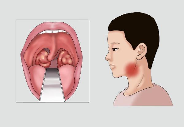 玫瑰精油正确使用方法